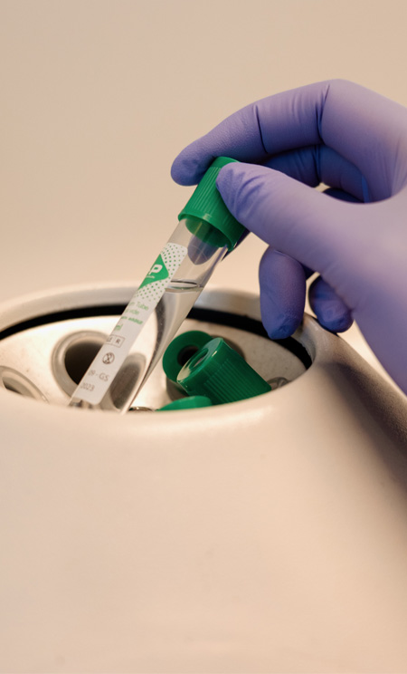 Platelet Rich Plasma (PRP)